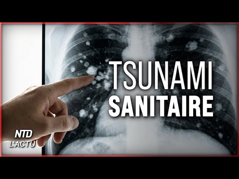 150 millions de Chinois avec des nodules pulmonaires : que se passe-t-il vraiment ?