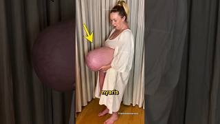 Download lagu Giving Birth to Triplets mp3