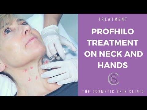 Profhilo treatment on neck and hands