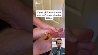 DOCTOR REACTS TO GIRLFRIEND POPPING FOOT PIMPLE!😱#shorts