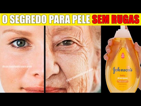 BASTA Fazer isso na PELE ! ACABE com as RUGAS, MANCHAS de MELASMA e Toda FLÁCIDEZ