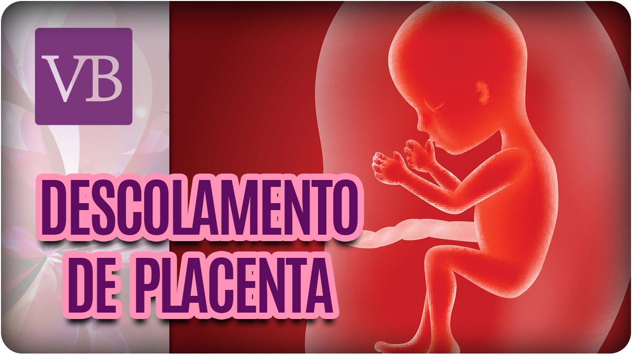 Descolamento de Placenta - Você Bonita (01/06/17)