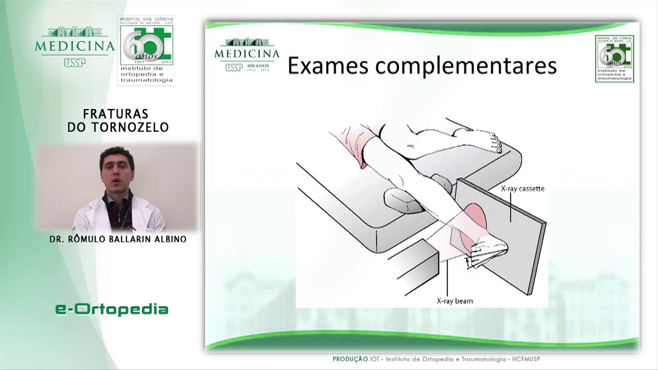 Fraturas do Tornozelo - Dr. Rômulo Ballarin Albino