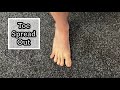Toe Spread Out
