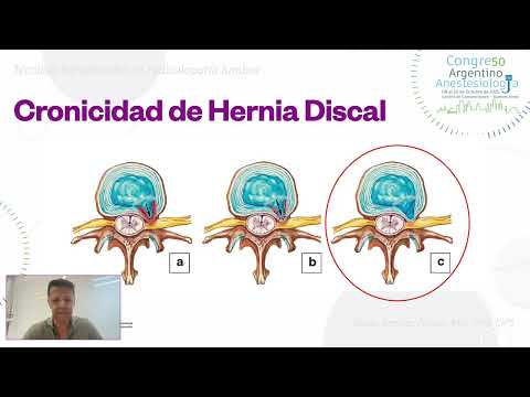 Diego Benitez Pareja-12