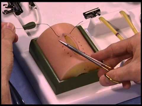 Common Errors in Performing an Instrument Tie: needle driver from outside example 2