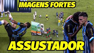 “PARECIA QUE IA M0RRER..FOI ASSUSTADOR..” O MOTIVO CHOCANTE DA LESÃO GRAVÍSSIMA DE GREMISTA