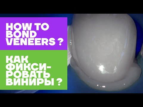 Veneer bonding. Фиксация винира