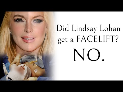 Did Lindsay Lohan Have Plastic Surgery? — Dr. Jonathan Zelken