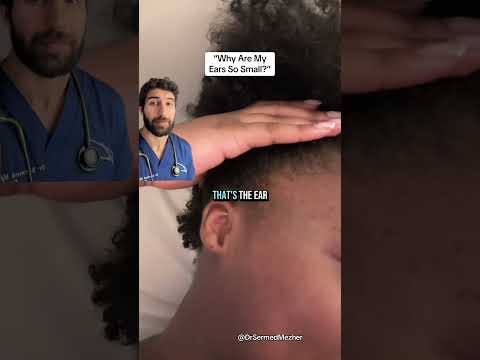 “Why Are My Ears So Small?” #fix