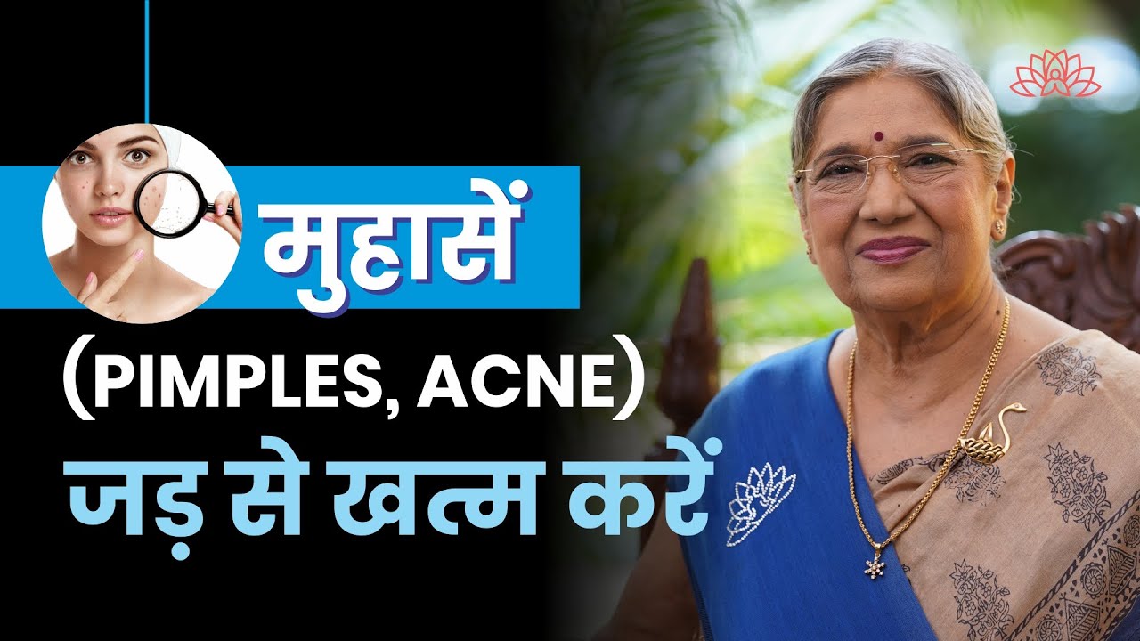 मुंहासे, दाग-धब्बे दूर करने के लिए अपनाये घरेलू नुस्खे | Acne and Pimples | Spotless Glowing Skin