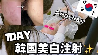 【韓国留学】韓国の皮膚科で美白注射を体験してきました✌️💖🇰🇷効果はあるのか?