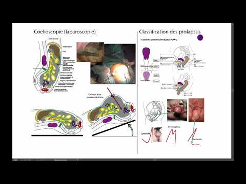 Ce trebuie să mănânci pentru creșterea penisului? - Ceai