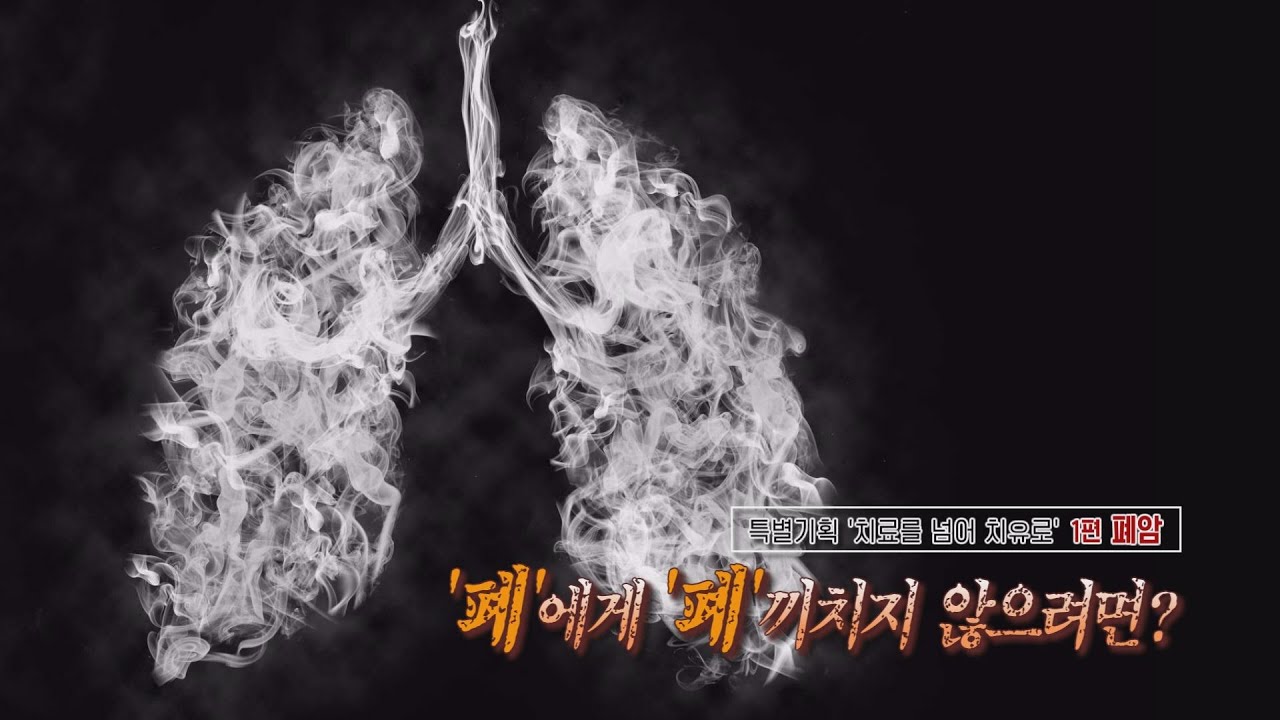 <특별기획> 치료를 넘어 치유로 1편 폐암 | 호흡기내과 박순효 교수 관련사진