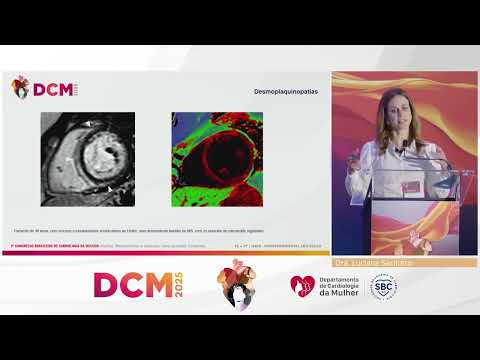 O que há de novo na abordagem das arritmias em mulheres?