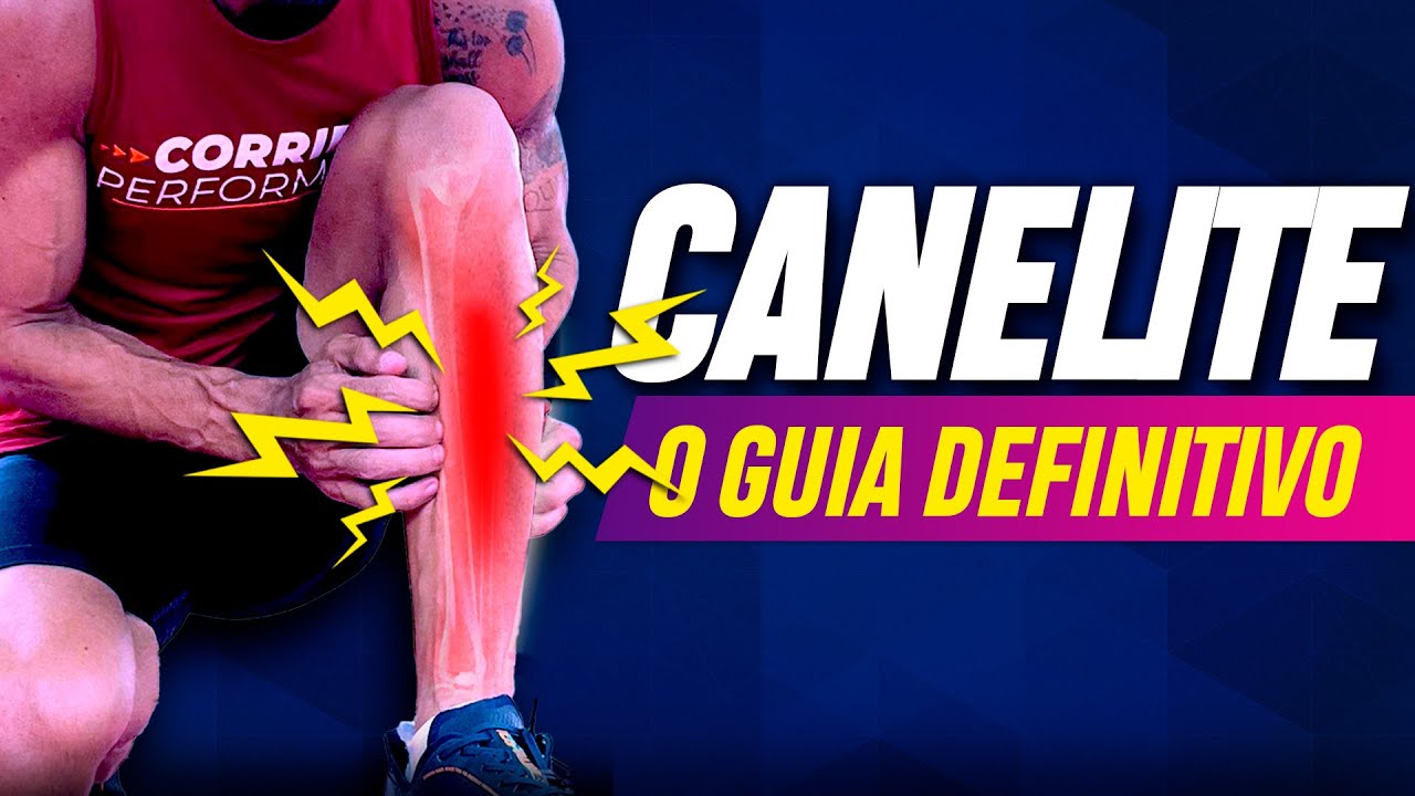 CANELITE NUNCA MAIS - O GUIA DEFINITIVO