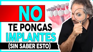 👉¿Que 𝗗𝗘𝗕𝗢 𝗦𝗔𝗕𝗘𝗥 del proceso de colocación de 𝗜𝗠𝗣𝗟𝗔𝗡𝗧𝗘𝗦 𝗗𝗘𝗡𝗧𝗔𝗟𝗘𝗦 para elegir a el DENTISTA ADECUADO