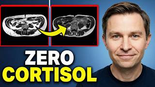 This Will Get You to 0% Visceral Fat in 30 Days (Drops Cortisol)
