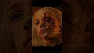 Download lagu Aemond lost an eye but gain the dragon | House Of Dragon #aemondtargaryen #houseofdragons mp3