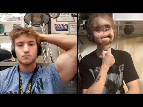 How Teen Survived Life-Changing Accident