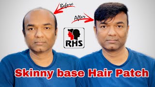 Miraz Hair Patch | Skin Base Hair Patch | Full Natural Hair Line | Hair patch For Men | 9599858612