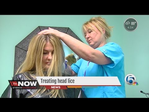 Treating head lice