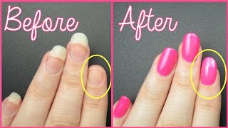 FIX A BROKEN NAIL FAST!