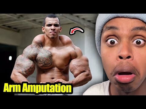 When Fake Muscles Goes Wrong...