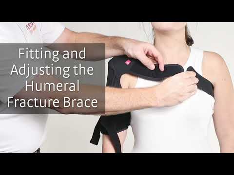 Fitting the Humeral Fracture Brace