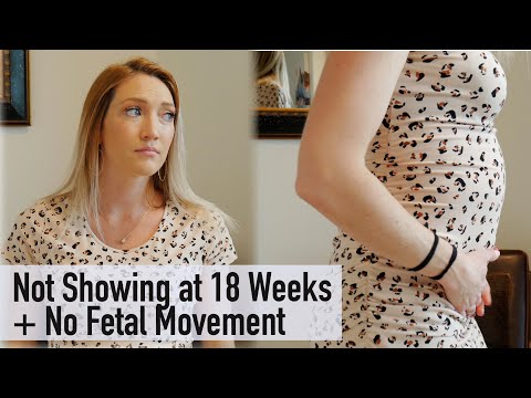 Baby Bump Not Growing in Second Trimester, Not Showing, and No Fetal Movement at 18 Weeks Pregnant