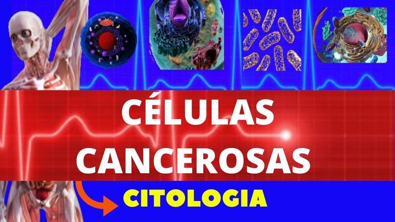 CÉLULAS CANCEROSAS (CÉLULAS CANCERÍGENAS) - O QUE É, COMO DESENVOLVE - CITOLOGIA