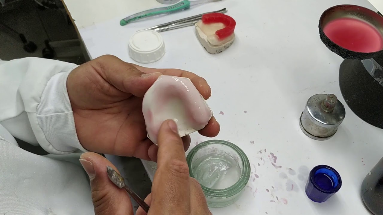 Placa de acrilico com rodete de cera - prótese total superior