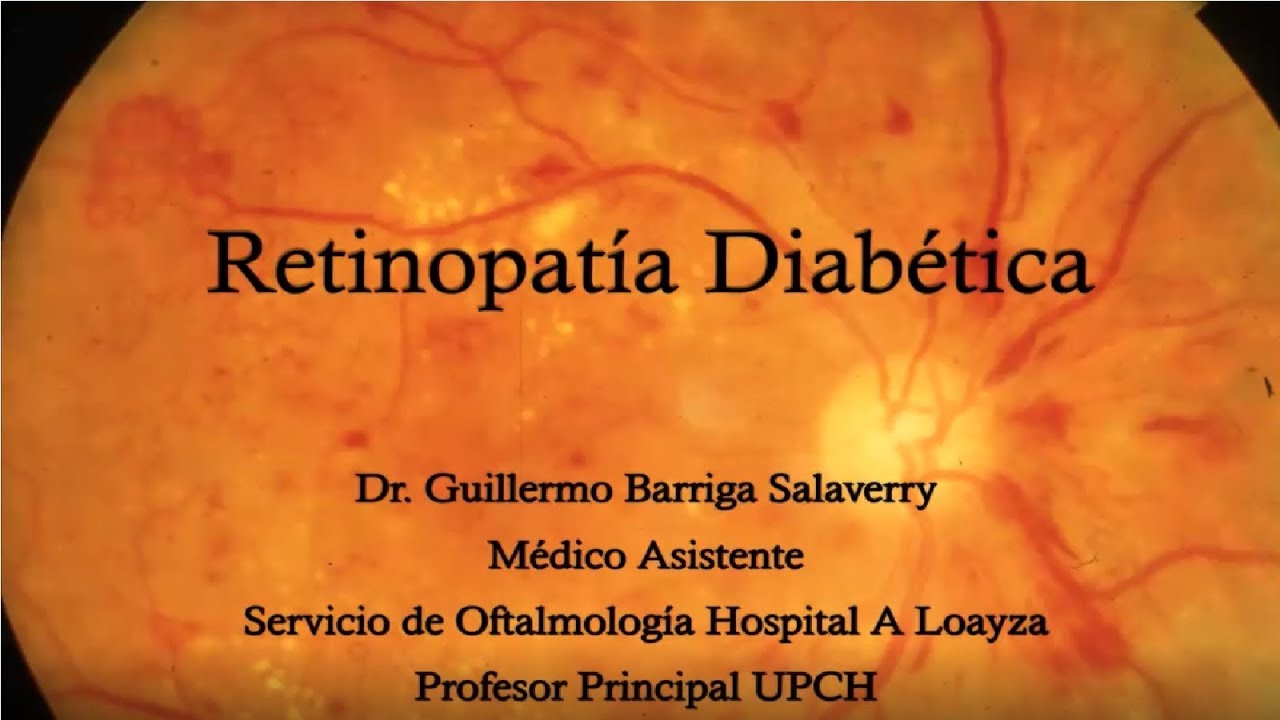 RETINOPATÍA DIABÉTICA