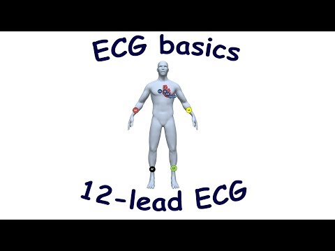 ECG basics: 12-lead ECG