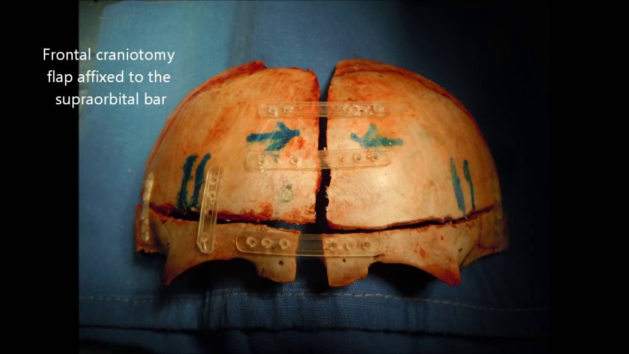 Carlos Alfonso Rodríguez Alvarez-12