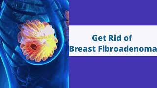 Breast Fibroadenoma Treatment Without Surgery in Hyderabad | VABB Treatment