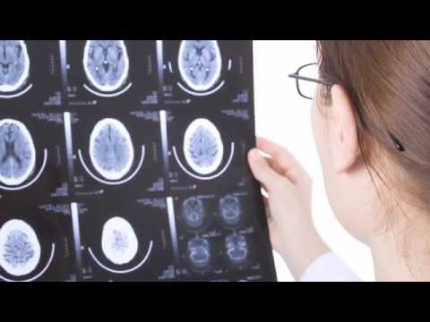 Brain Spinal Cord Injury San Francisco CA Attorney