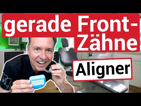 Gerade Zähne mit Alignern I mit der ABC-Technik zum strahlenden Lächeln