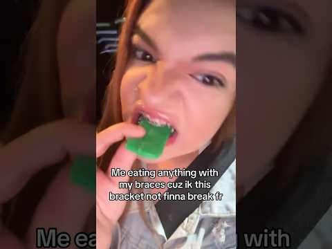 How 1 Broken Bracket Can Set You Back 4 MONTHS! 😳🦷