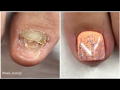 Most Satisfying Pedicure Transformation 😱 best nail polish for toes 2022
