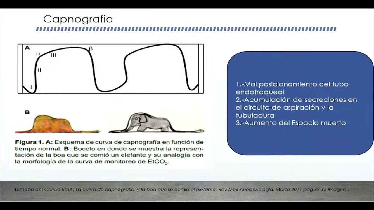 Monitoreo de la ventilación mecánica y las intervenciones de Enfermería
