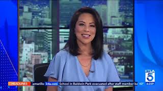 Long Beach Medical Center Completes World’s First Robotic Hip Revision- KTLA at 6PM