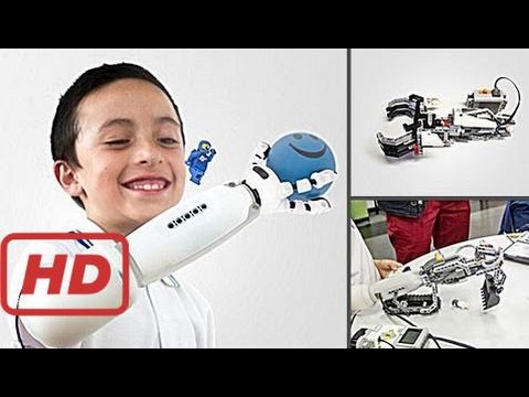 TNG- 5 Amazing Prosthetic Gadgets That Make Life Easier