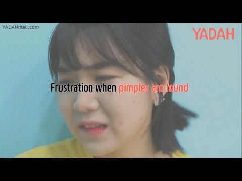 Frustrating Moments With Pimples(Anti-T Red Spot Zero Cream) / yadahmall.com / YADAH Singapore