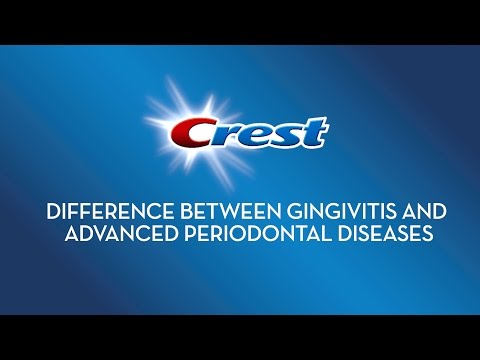 Difference between Gingivitis and Advanced Periodontal Diseases | Crest