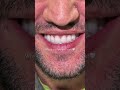 Why Do Love Your Work Dentist Dentalcare Dentistry Couple