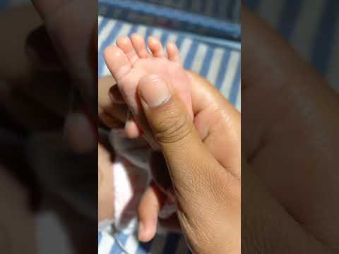 How to check jaundice in New Born Baby #newbornbaby #babycare #shortbaby #shorts