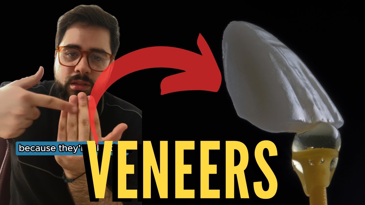 Let's talk about Veneers