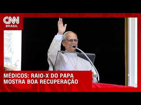 Raio-x do papa Leão XIV mostra boa recuperação, dizem médicos | LIVE CNN