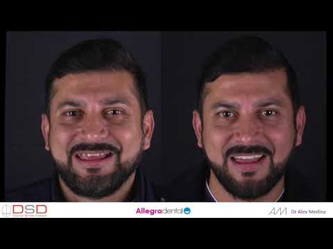 PROBLEMAS CARDÍACOS: INFARTOS A EDADES TEMPRANAS II